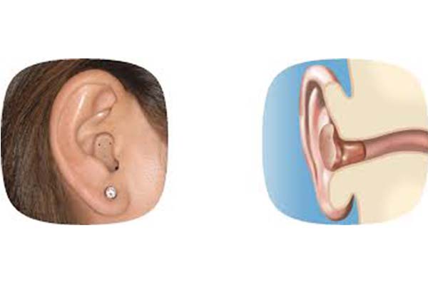 ITC Hearing Aid